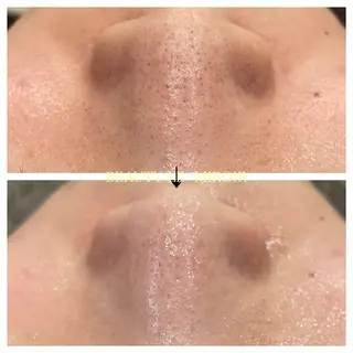 ビューティー ミロワールのエステ・リラクイメージ