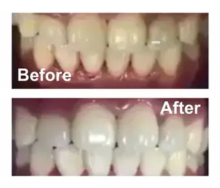 KalanDiva〜 ｶﾗﾝﾃﾞｨｰﾊﾞ〜のエステ・リラクイメージ