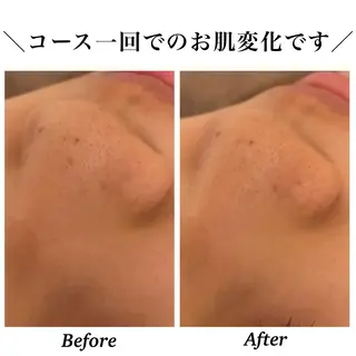 Bellesthe (ベルエステ)のエステ・リラクイメージ