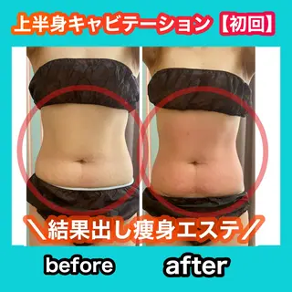 痩身/脱毛/ネイル HARUKAのエステ・リラクイメージ