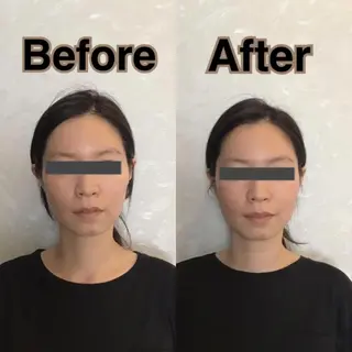 姿勢・骨盤/小顔矯正 痩身ダイエット 横田のエステ・リラクイメージ