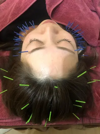 美容鍼灸女性専用 りんご鍼灸治療院のその他イメージ