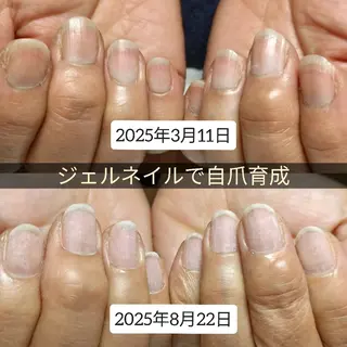 ネイル 深爪矯正/爪育成ケア manie nailのネイルデザイン