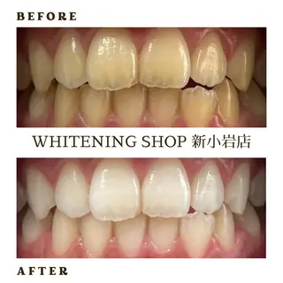 メンズ ホワイトニング ショップ新小岩店のその他イメージ