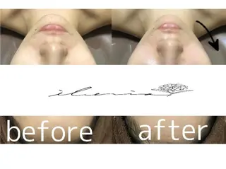 心斎橋痩身ダイエット 韓国.美容鍼.小顔のエステ・リラクイメージ