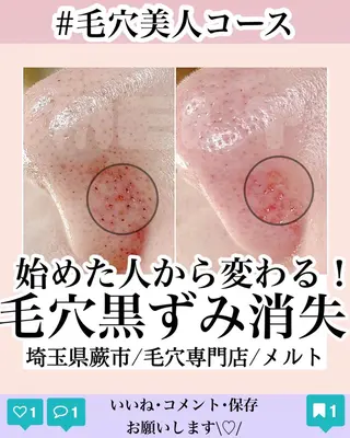 C. Lのマツエク・マツパデザイン