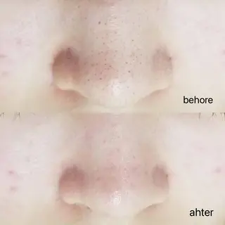 Anacia Beauty Salon所属・美肌脱毛&毛穴専門 Anaciaのエステ・リラクイメージ