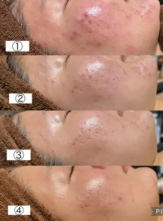 Beauty   Salon  Adiy所属・Adiy ikumiのエステ・リラクイメージ