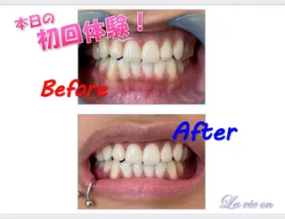 セルフホワイトニングサロン　ラヴィアン所属・ホワイトニングサロン La vie enのその他イメージ