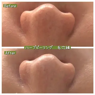 ぱんだ王国エステ所属・ぱんだ王国 エステのエステ・リラクイメージ