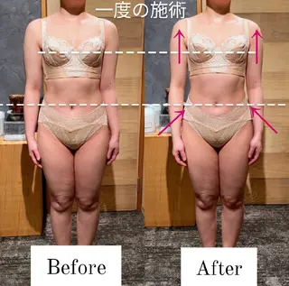 深層リンパの癒し 美姿勢×痩身✨のエステ・リラクイメージ