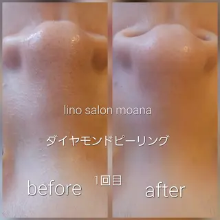 lino salon moana所属・lino salon  moanaのエステ・リラクイメージ