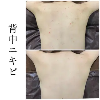 ハーブピーリング専門 BIOEL横浜のエステ・リラクイメージ