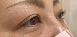 ใใใจใฏใปใใใ ๐๐๐๐๐ ๐ฆ๐ใฎใใใจใฏใปใใใใใถใคใณ