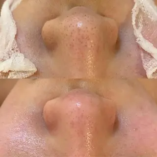 BELCIA福岡店　récolte de BELCIA（レコルトデベルシア）所属・BELCIA福岡店 レコルトデベルシアのエステ・リラクイメージ