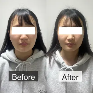 脱毛専門サロン BELFINE恵比寿のエステ・リラクイメージ