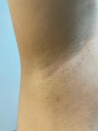 脱毛SALON RaYNiCKのエステ・リラクイメージ