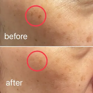 痛くないシミ取り 【荻窪】石橋のヘアスタイル