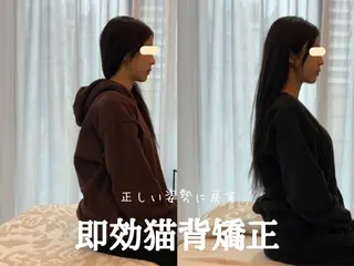 最速小顔・肌質管理 ❣️エスポワールのエステ・リラクイメージ