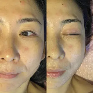 Meetite 小林のエステ・リラクイメージ