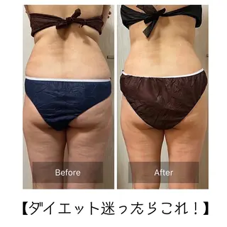 本気で痩せたい方へ 痩身専門サロンのその他イメージ