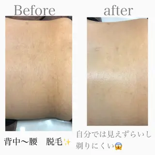 美肌脱毛と癒しのプライベートサロン。gratia~グレイティア~所属・gratia ~グレイティア~のエステ・リラクイメージ