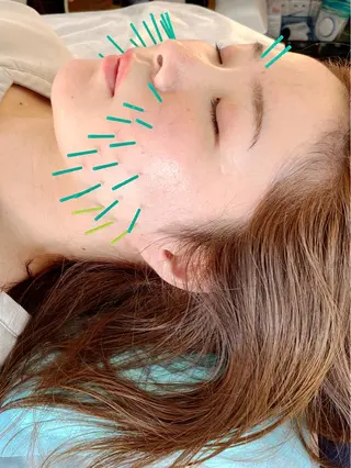 小顔美容鍼専門サロン 渋谷YZのエステ・リラクイメージ