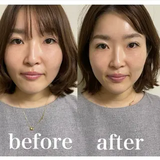 美容鍼灸サロン mahoroba院長のエステ・リラクイメージ