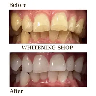 ホワイトニングショップ伊丹店所属・ホワイトニング ショップ伊丹店のその他イメージ