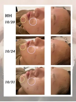 ベルーテ エッセンスのエステ・リラクイメージ