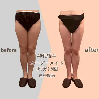 痩身エステ Julien麹町店のエステ・リラクイメージ