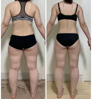 ニキビ・ 肌荒れ専門店のエステ・リラクイメージ