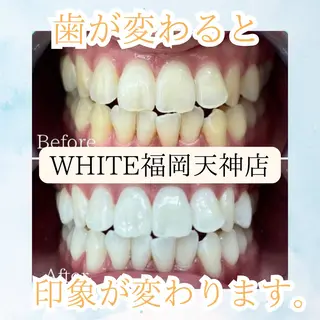 メンズ ホワイトニング専門店 WHITE天神店のエステ・リラクイメージ
