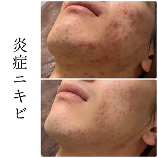 ハーブピーリング専門 BIOEL横浜のエステ・リラクイメージ