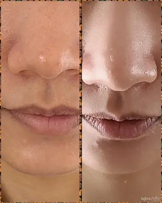 最新マシーン氣顔 REBORN幸田のエステ・リラクイメージ