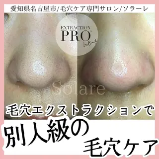  毛穴洗浄・まつ毛 の専門店 ソラーレのエステ・リラクイメージ