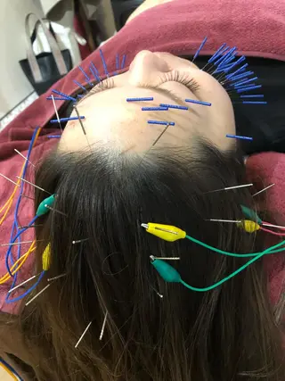 美容鍼灸女性専用 りんご鍼灸治療院のその他イメージ