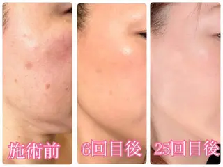 まつげ屋さん こはくのマツエク・マツパデザイン