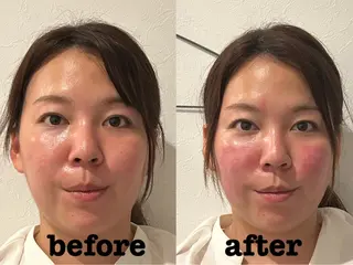美容鍼灸Solana所属・小櫻 唯のエステ・リラクイメージ