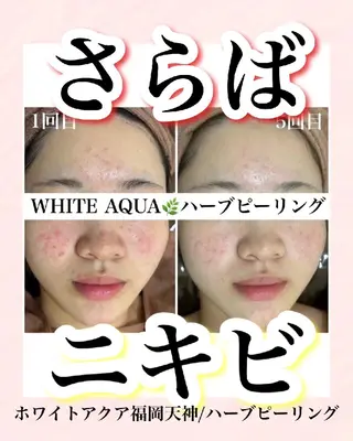メンズ キッズ WHITEAQUA 福岡天神店のエステ・リラクイメージ