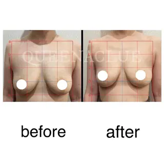 毛穴改善/脱毛 ネイル 川上久仁子のエステ・リラクイメージ