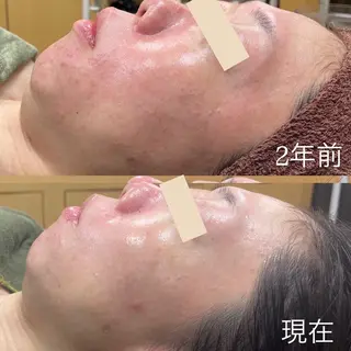 吉井 奈緒美のマツエク・マツパデザイン