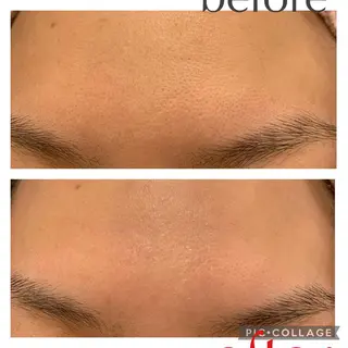 Lino Uのネイルデザイン