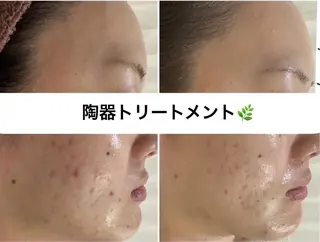 WHITE AQUA 🌼柏店のエステ・リラクイメージ