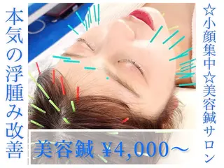 小顔美容鍼専門サロン 渋谷YZのエステ・リラクイメージ