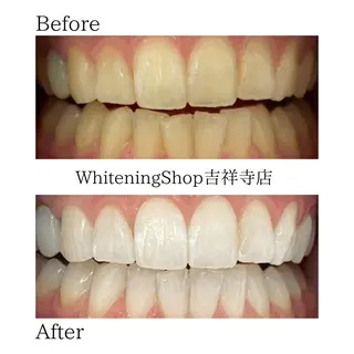 ホワイトニング ショップ吉祥寺店のエステ・リラクイメージ