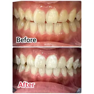 プラチナムビューティー柏所属・【歯科提携】柏ホワイ トニングスタイルのその他イメージ