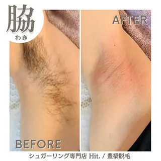 Hit. シュガーリング豊橋のエステ・リラクイメージ