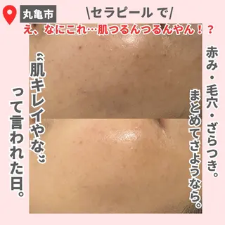 前山 くるみのエステ・リラクイメージ