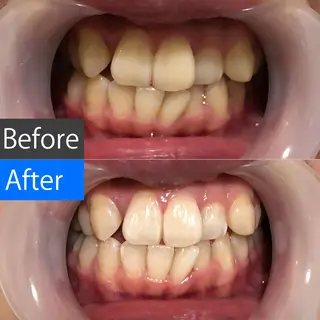 パーマ マツエク・マツパ ミディアム カラー ネイル メンズ キッズ アイブロウ 中目黒 ホワイトニングサロンのその他イメージ